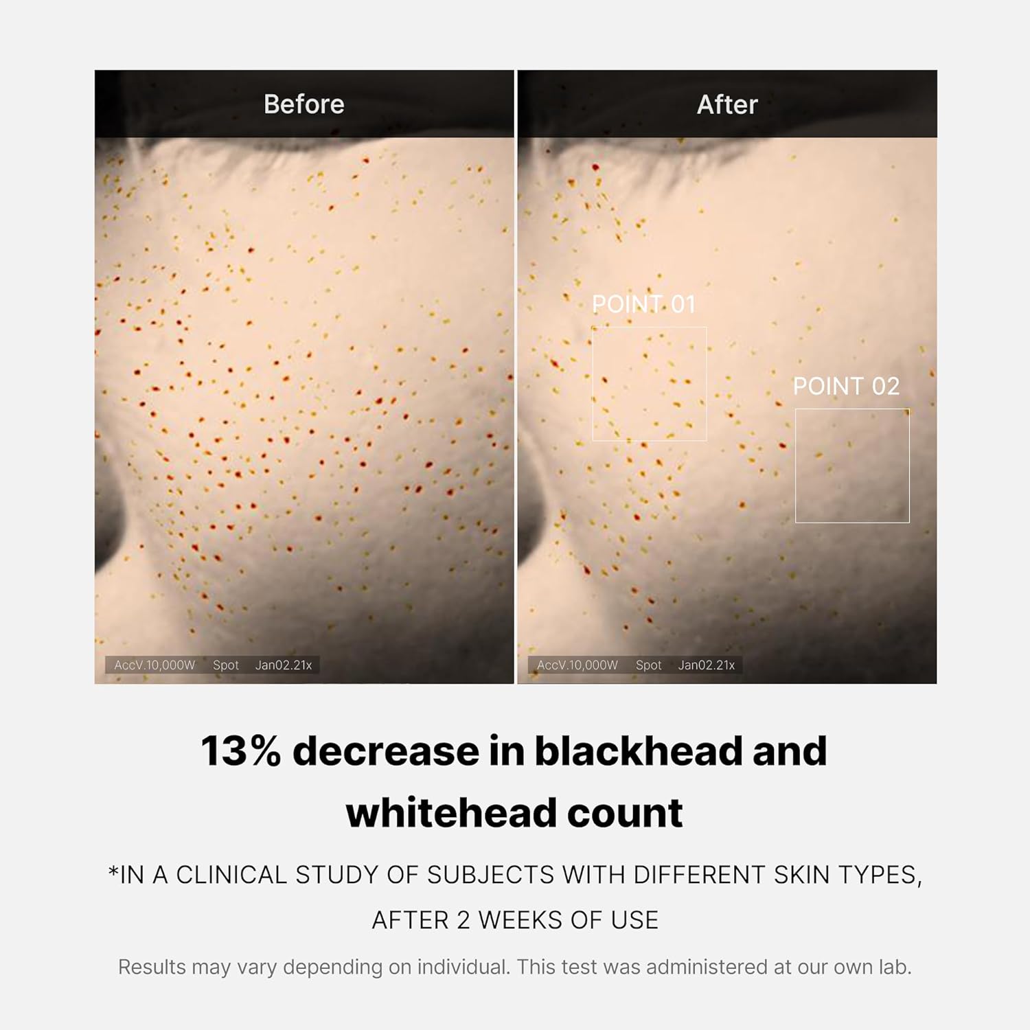 medicube Medicube Zero Pore One-day Serum 1.01 fl.oz - Overnight Resurfacing Serum with Pore Tightening Complex - 15.2% AHA+BHA+PHA & 2% Niacinamide - 10.8% reduction in pore appearance after one